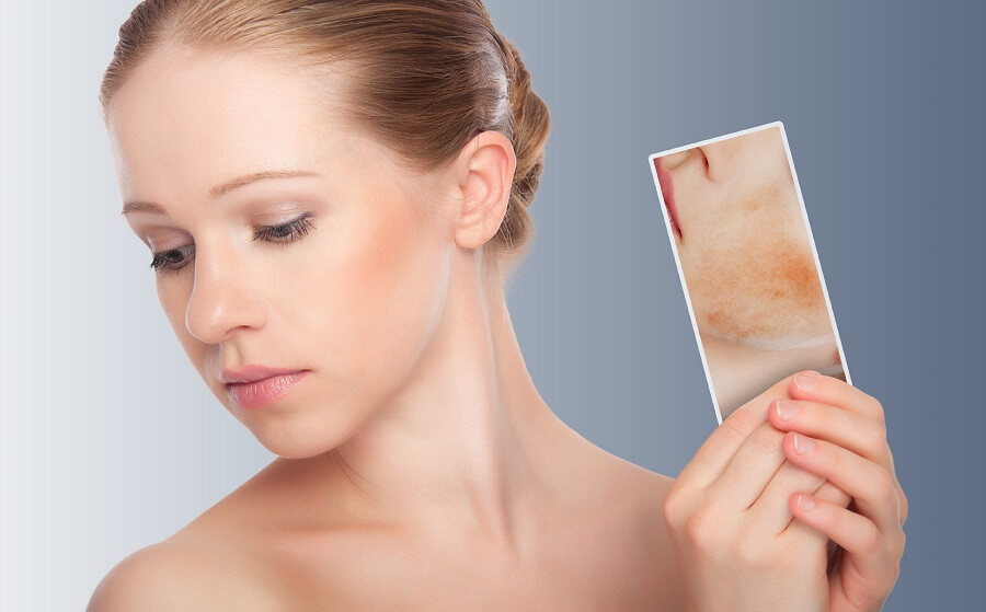 woman with healthy complexion holding a picture of a complexion with blemishes
