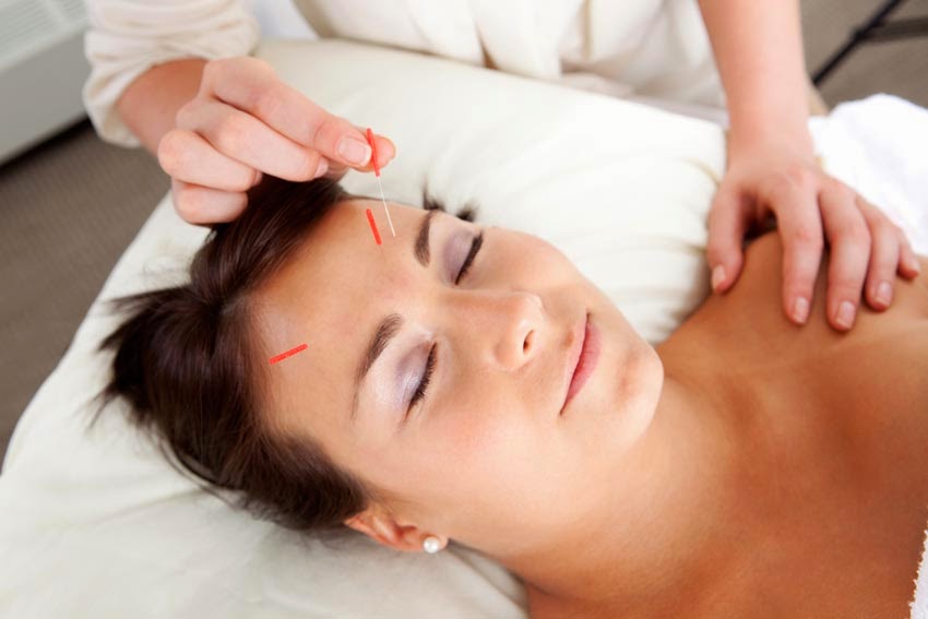 woman getting facial acupuncture