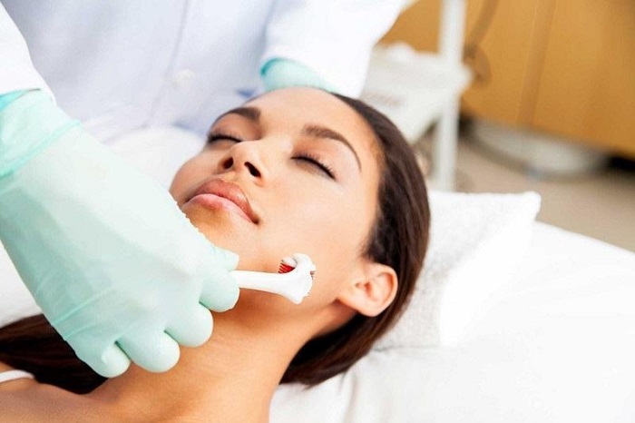 what is micro needling